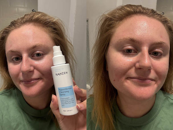 Indybest best hypochlorous acid spray review Kanzen cleansing antibacterial water