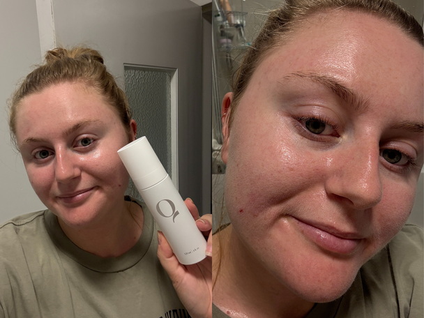 Indybest best hypochlorous acid spray review Qure Skincare dermal mist hypochlorous acid spray