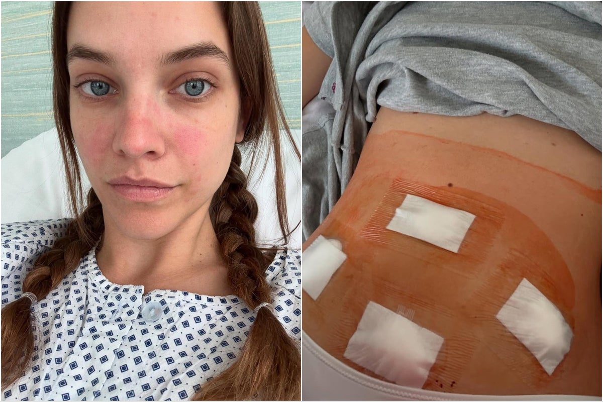 Barbara Palvin shares secret health battle after undergoing surgery Barbara Palvin shares secret health battle after undergoing surgery