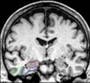 Compound found in hot drink could protect brain against Alzheimer’s