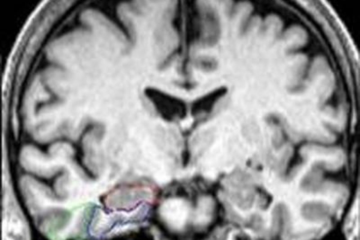 Natural compound found in popular hot drink could protect brain against Alzheimer’s, study finds