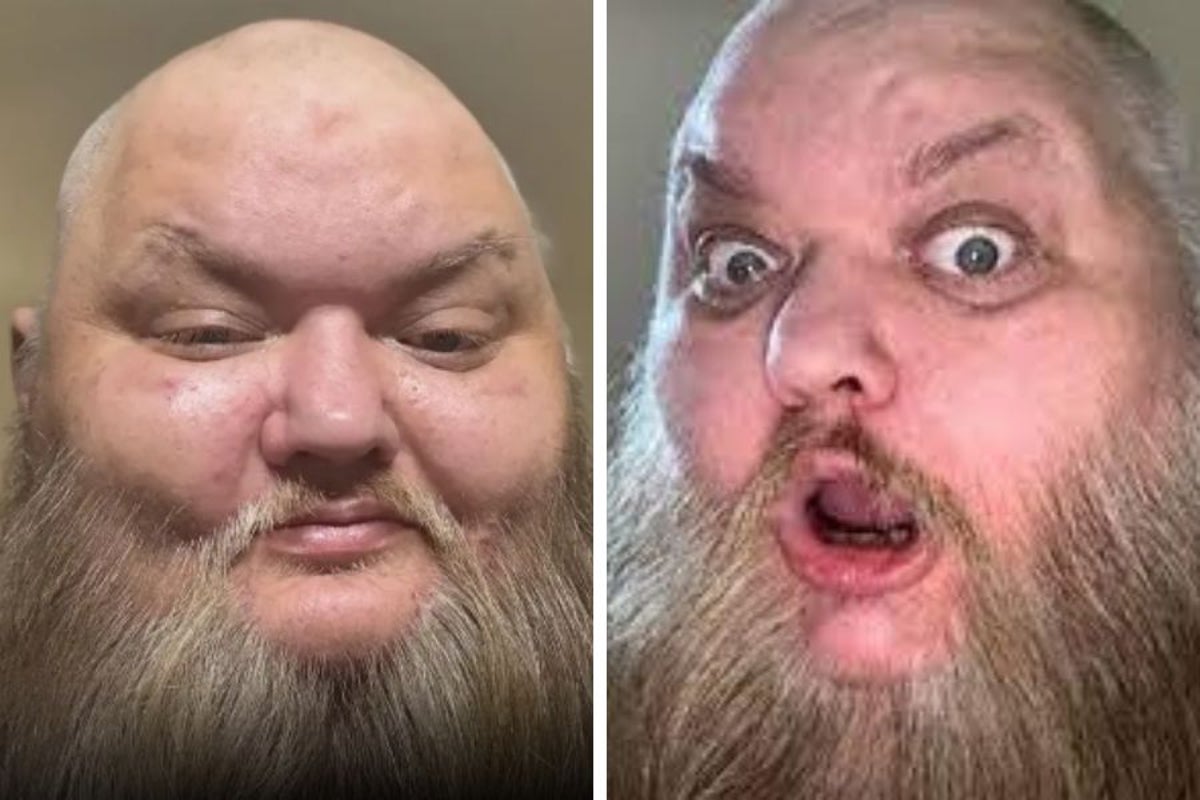 John Crawley, also known as TikTok star KingBeard X, dies aged 47 John Crawley, also known as TikTok star KingBeard X, dies aged 47