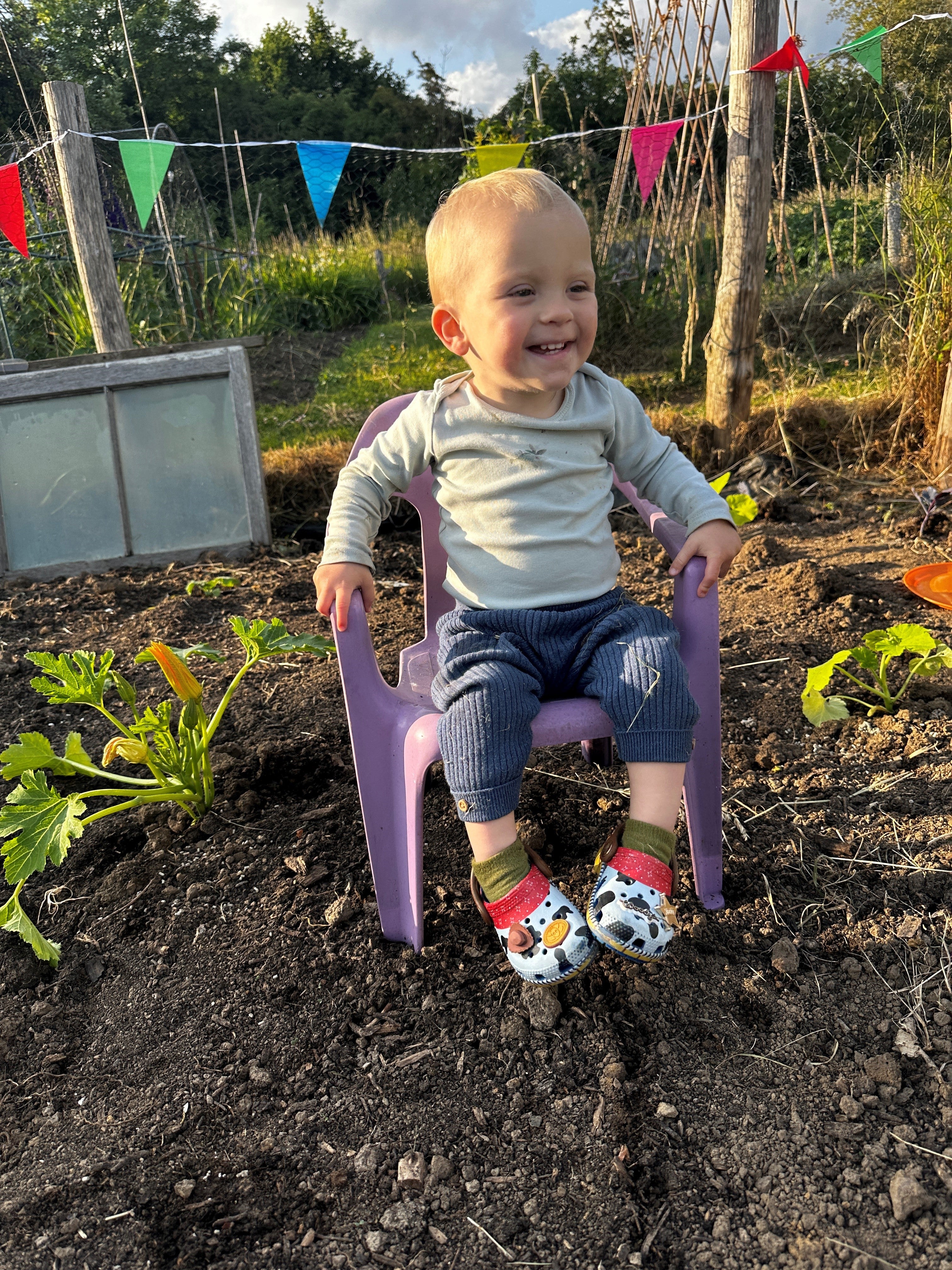 Woody Mayers, aged 22 months, who has a rare inherited anaemia called congenital dyserythropoietic anaemia (CDA) type 1