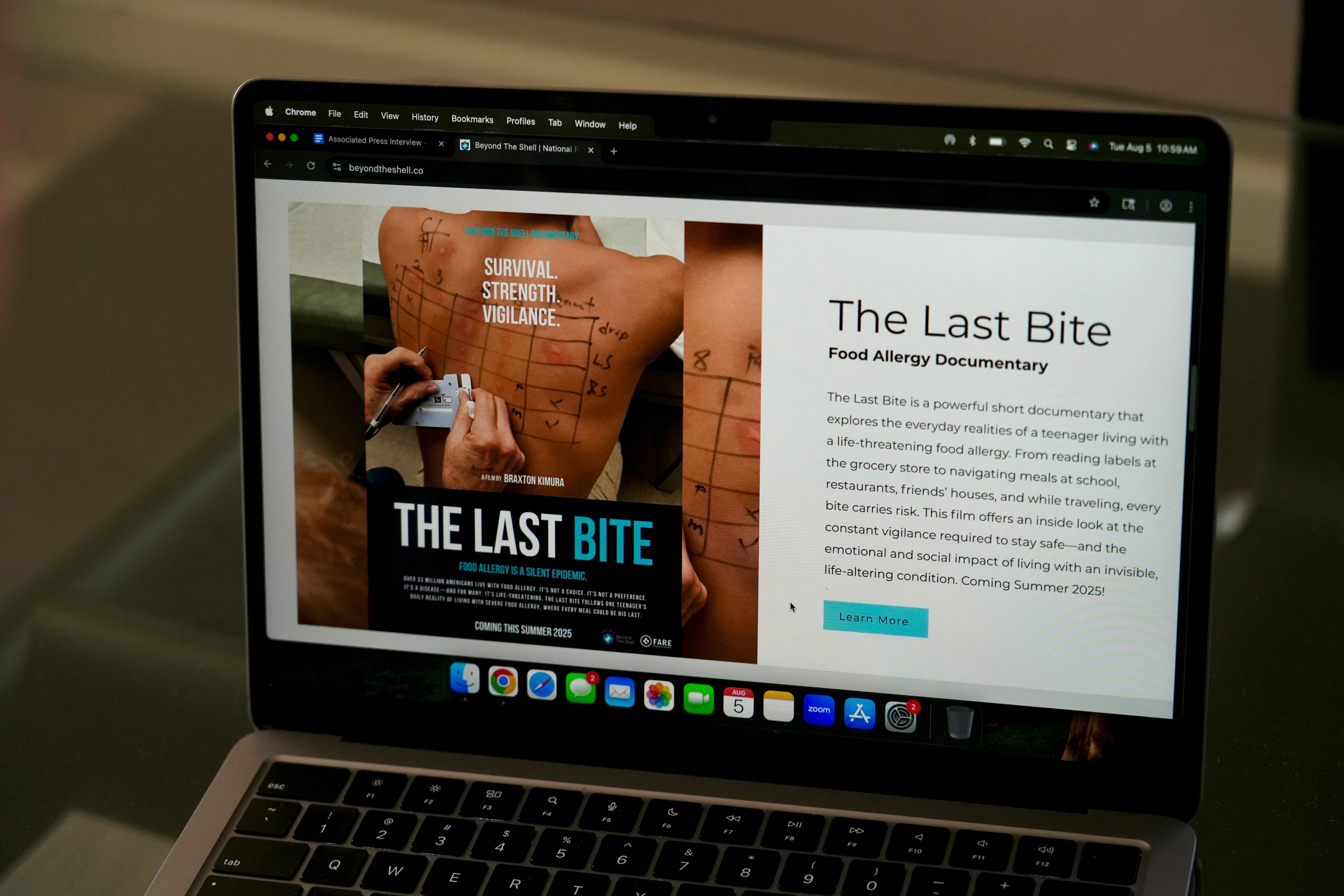 California Restaurants Food Allergies