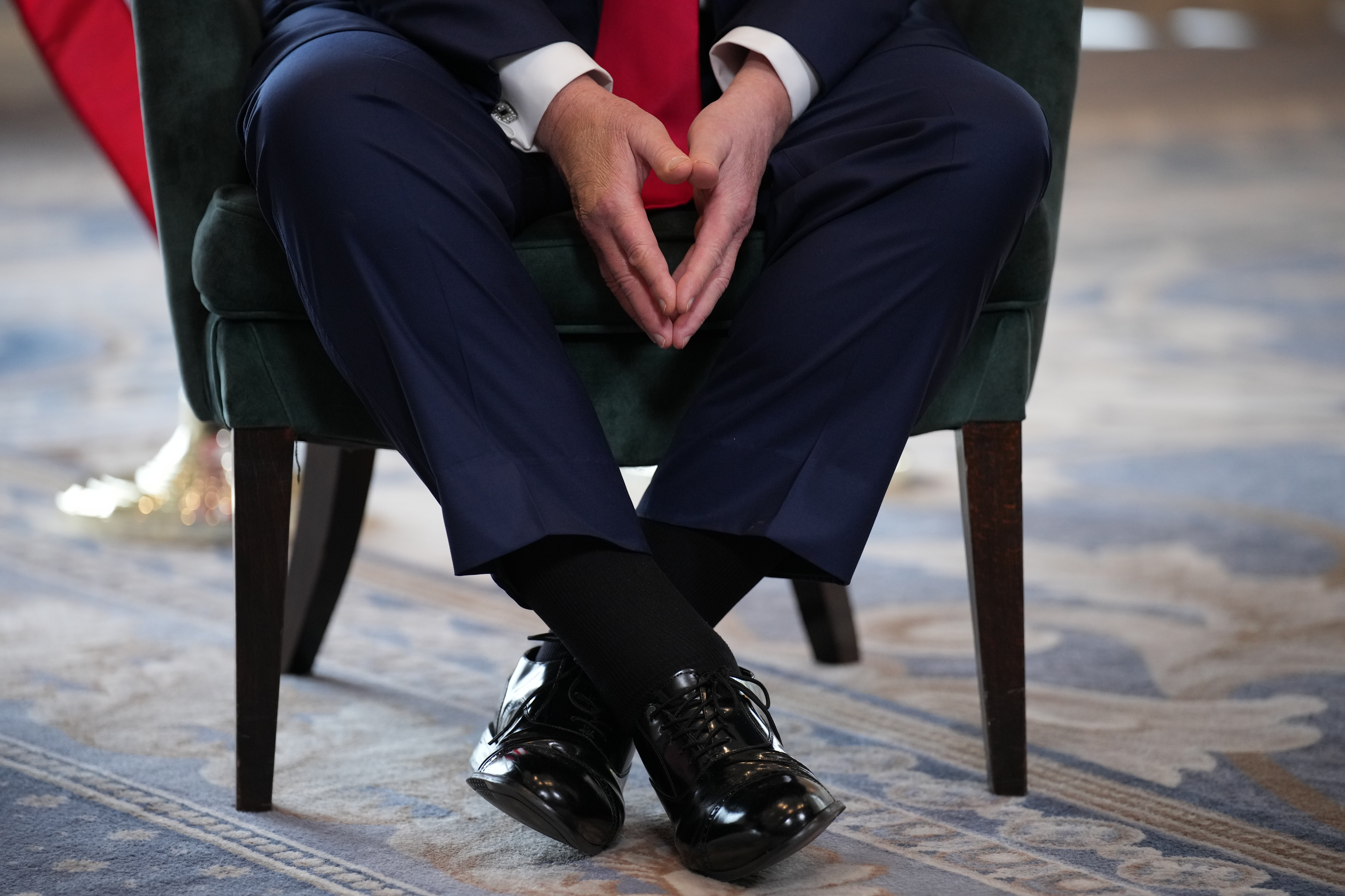Trump's swollen ankles were on display during a trip to Scotland on July 28