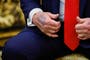 Trump reveals dark bruising on hand in Oval Office