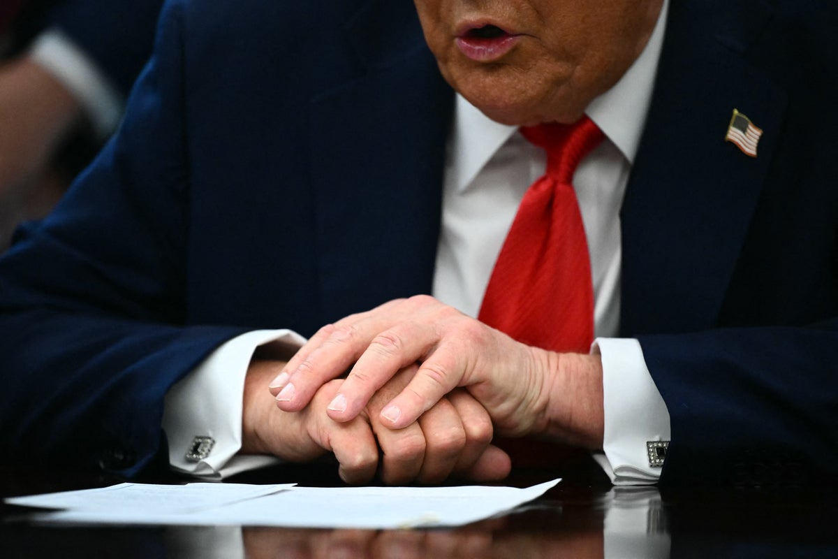 Trump covers bruises on hand while speaking with reporters in Oval Office