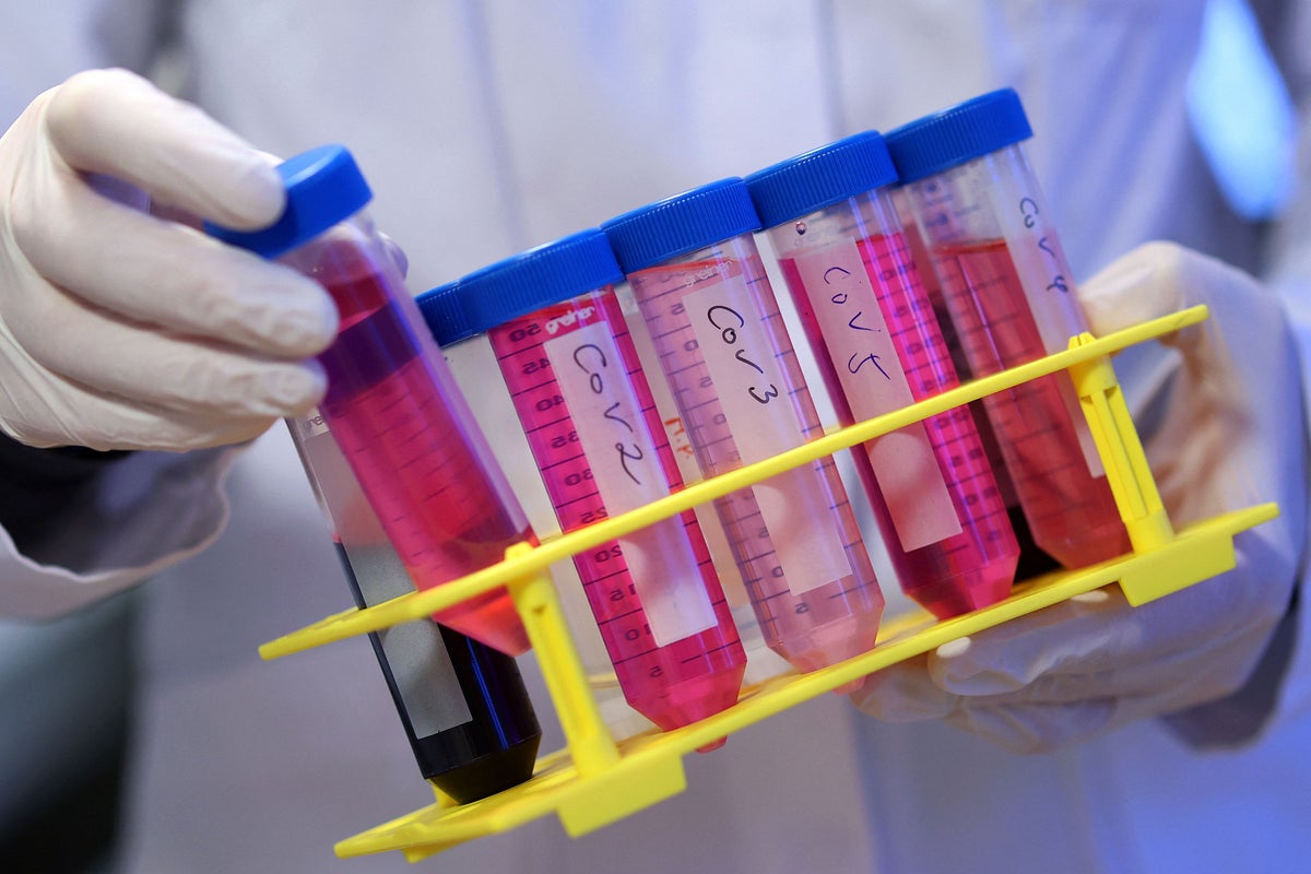 Long Covid causes effects similar to Parkinson’s or stroke, scientists find