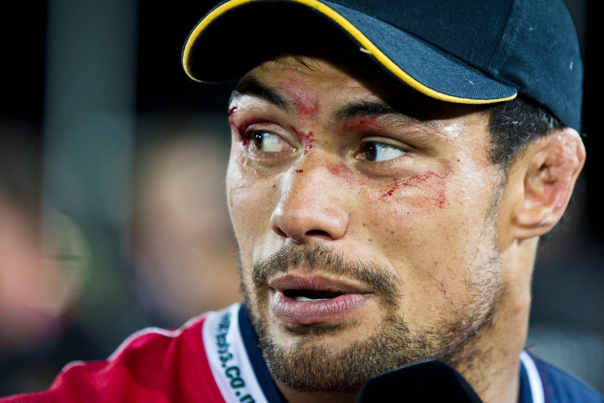 Ex-rugby player Shane Christie, who called for study of concussion, dies at age 39