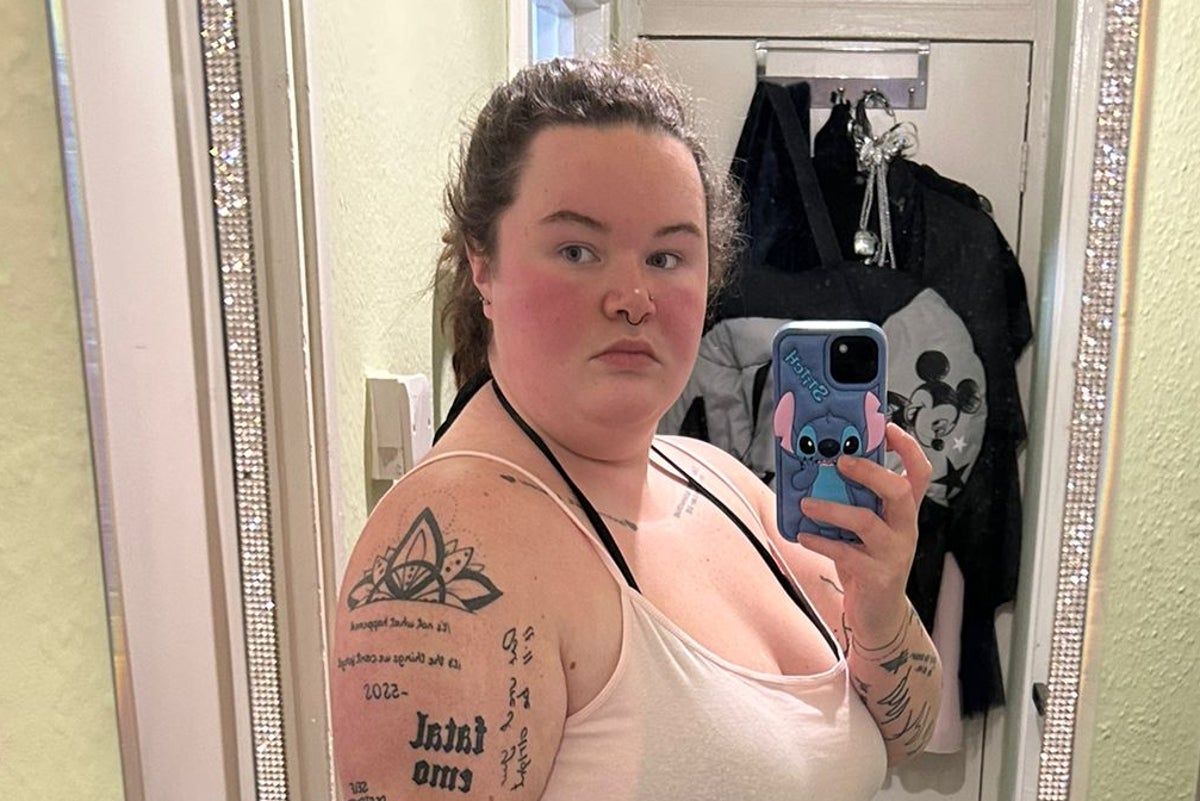 ‘Mounjaro is making my hair fall out – but it’s worth it to lose weight’