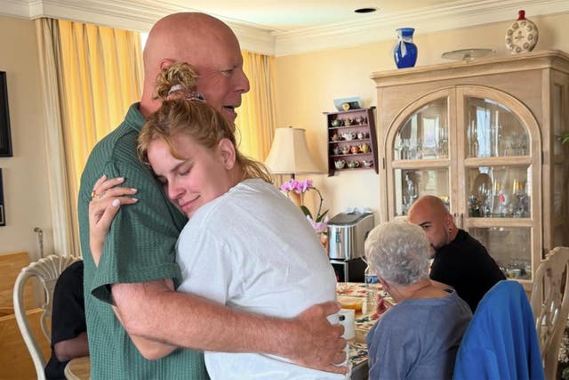 <p>Frontotemporal dementia is an umbrella term for brain diseases that mainly affect the frontal and temporal lobes of the brain, according to the Mayo Clinic.</p>