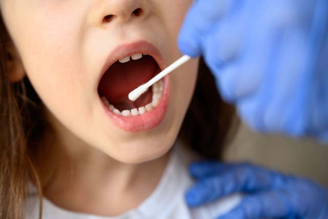 <p>The study found cheek swabs revealed changes in the youngsters up to five years before they were diagnosed (Alamy/PA)</p>