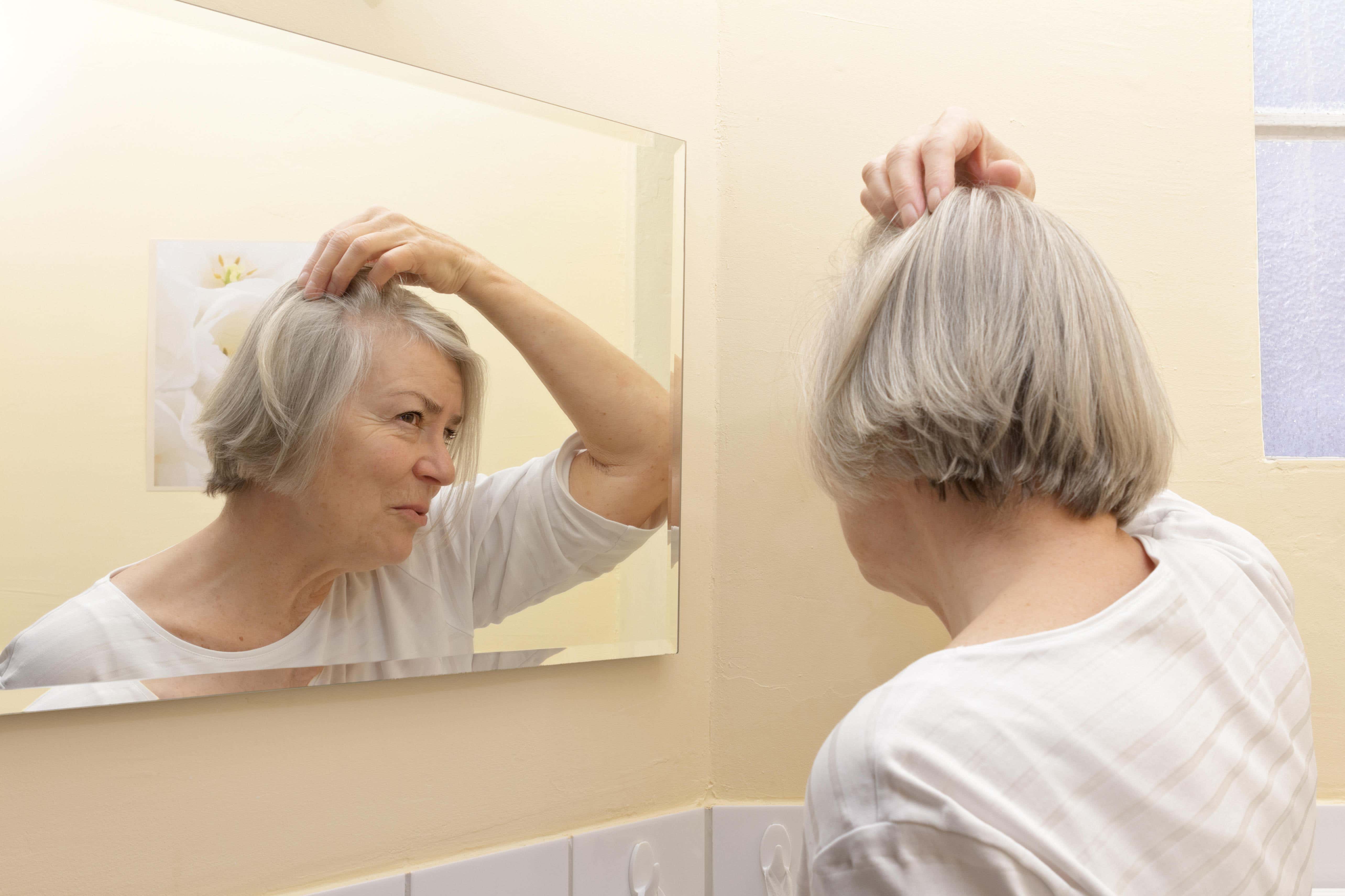 <p>Here are some of the reasons your hair may be thinning</p>