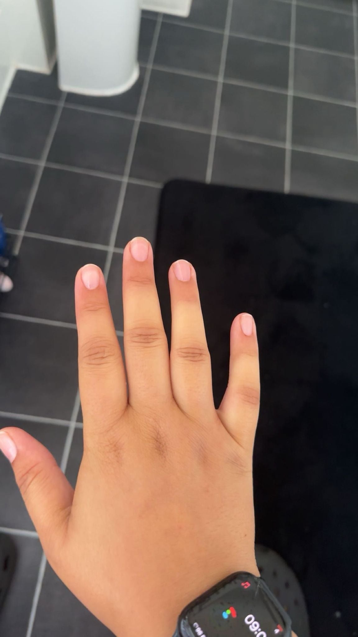 Ms Rey noticed her fingers were swollen prior to the diagnosis