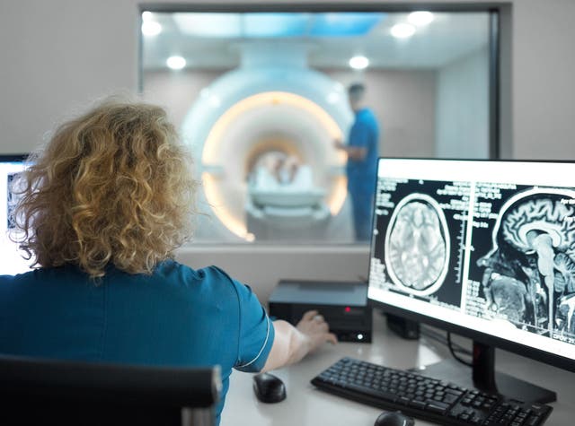 <p>Researchers at University College London have developed a way of running MRI scans to achieve the same results in a third of the time</p>