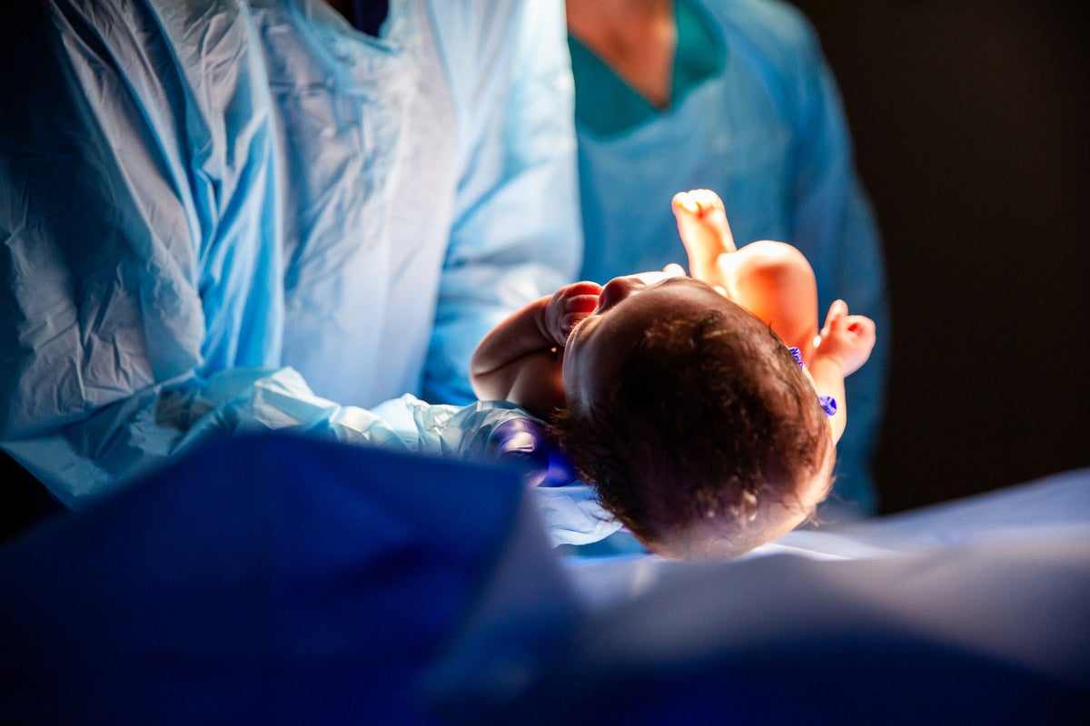 More than half of UK babies born with medical intervention, maternal care audit finds