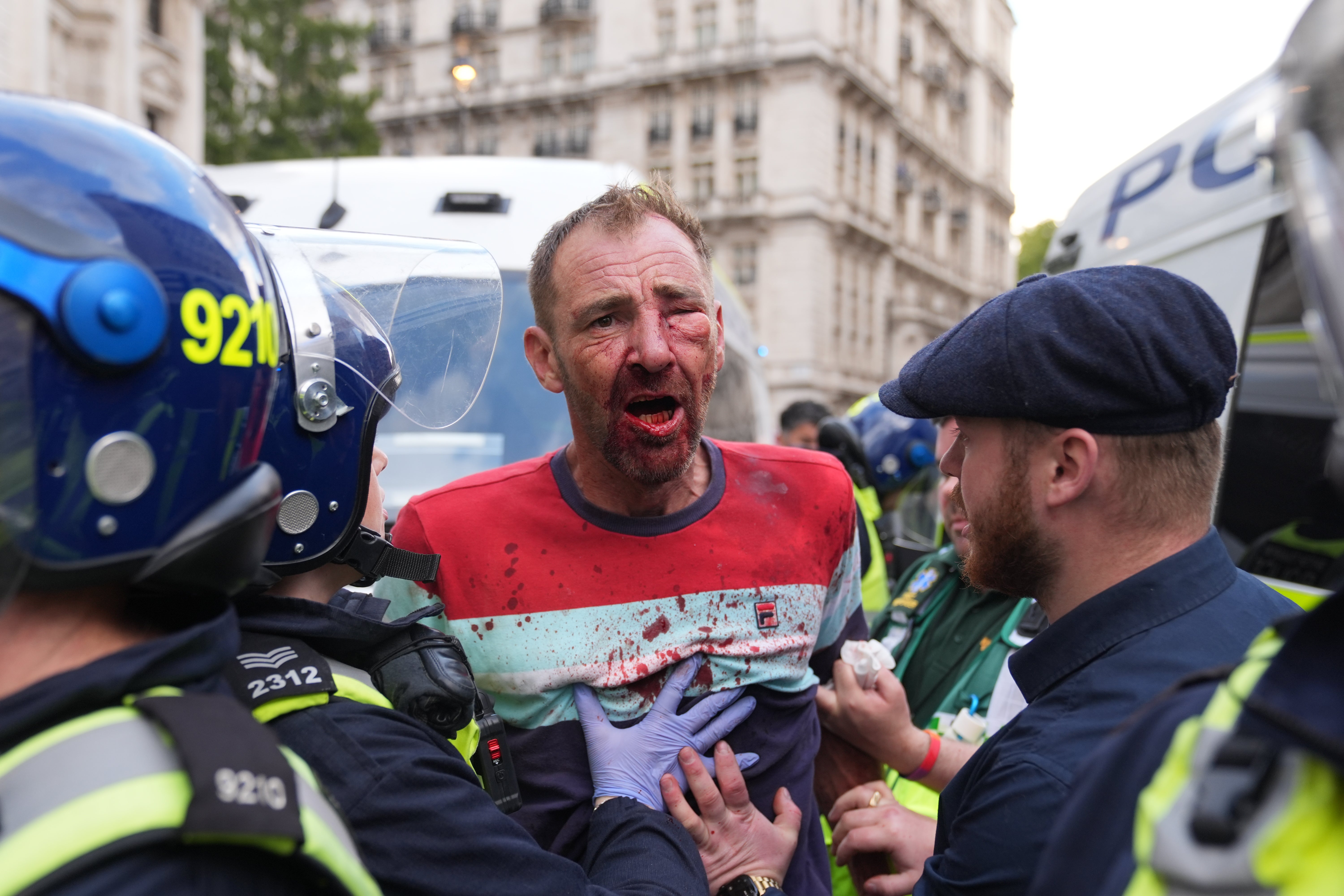 A person with a bloodied face and clothing confronts police officers during the Tommy Robinson-led Unite the Kingdom march and rally on Whitehall in central London.