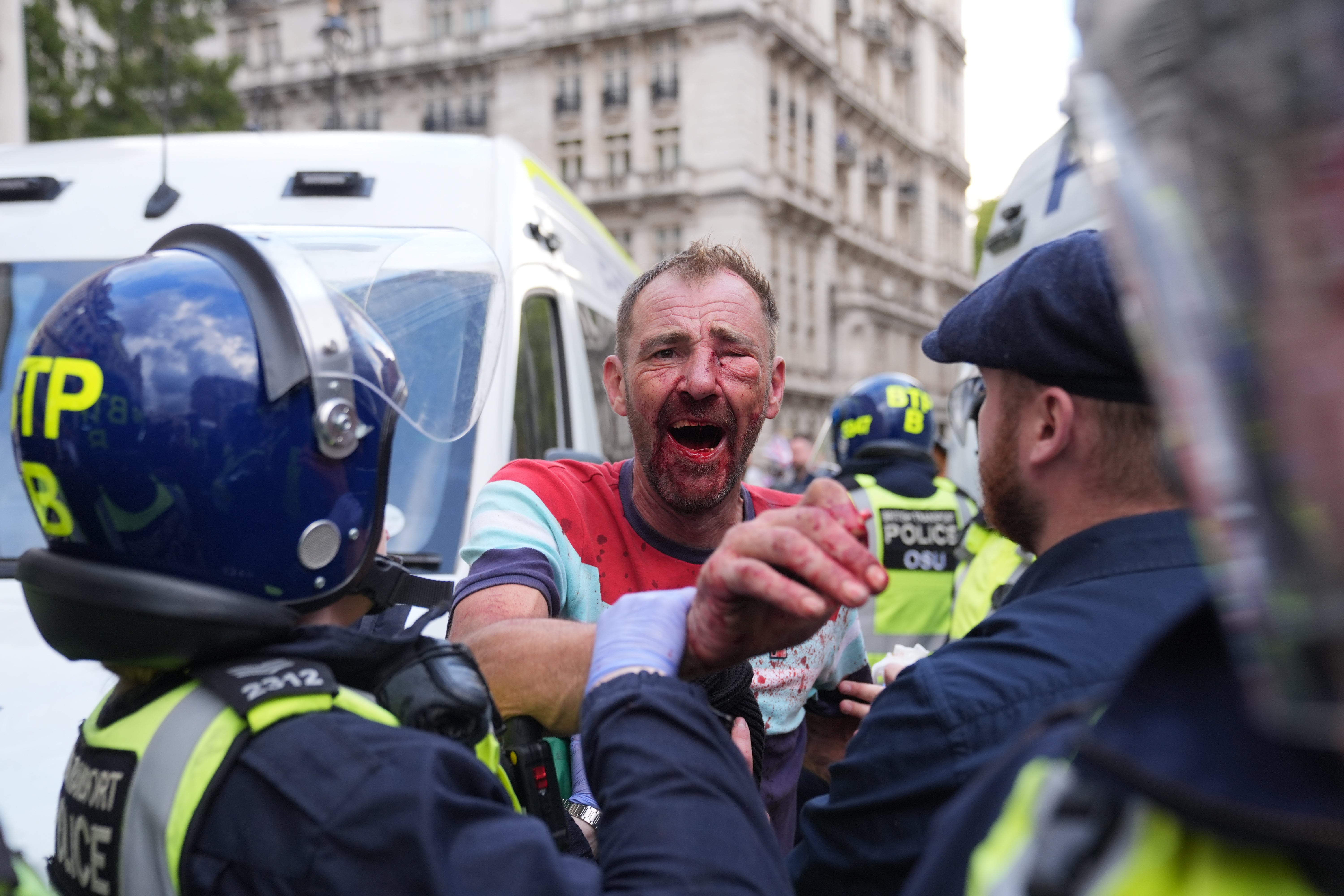 A person with a bloodied face and clothing confronts police officers during the Tommy Robinson-led Unite the Kingdom march and rally on Whitehall in central London
