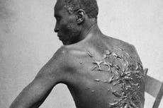 National park to remove exhibit of famed photograph showing former slave’s scarred back, says report