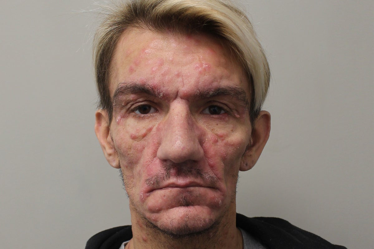 Police think there may be hundreds more victims of rapist who transmitted STIs