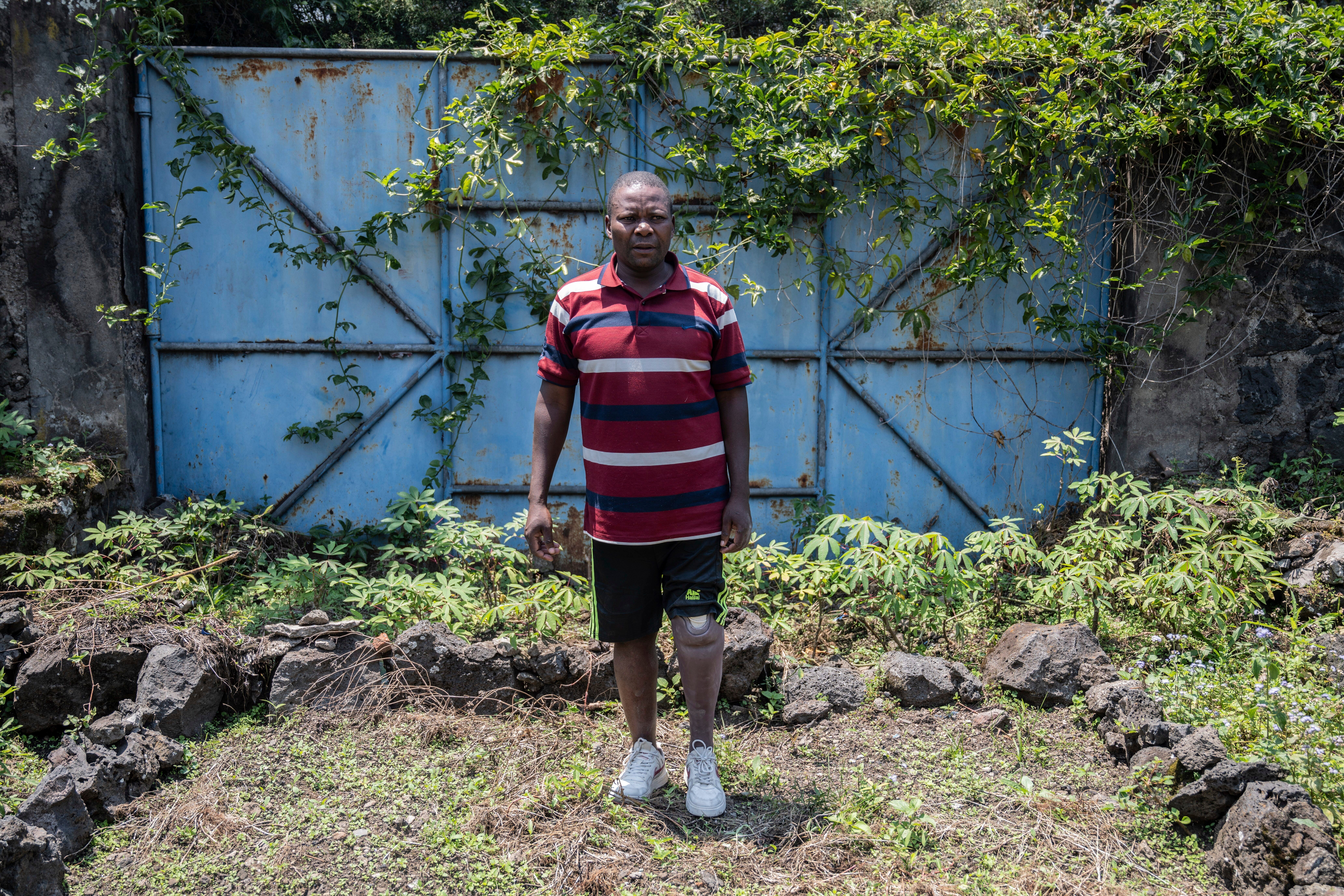 Congo Conflict Injured