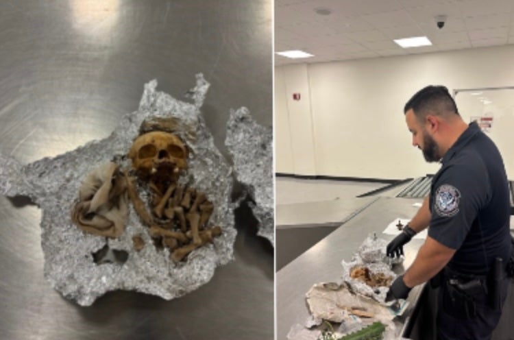 <p>A suspected human skull and bones were discovered in a passenger’s luggage at a Florida airport, giving authorities 'a bone to pick'</p>