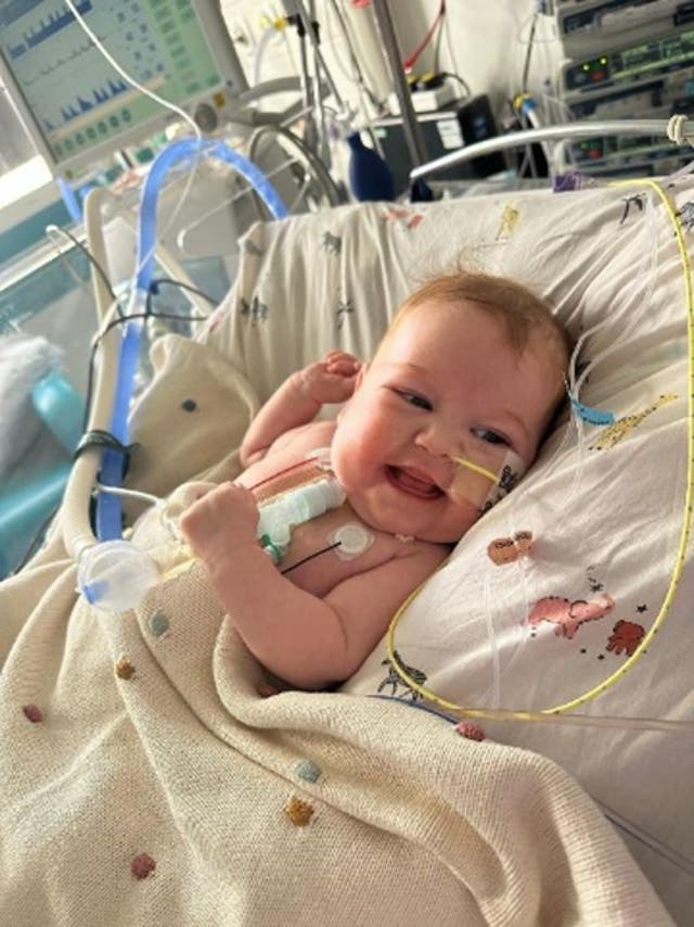 <p>Six-month-old Rory Fletcher is on the urgent heart transplant waiting list </p>