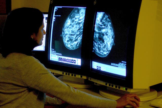 <p>Mammograms can detect breast cancer early, often before a lump can be felt</p>