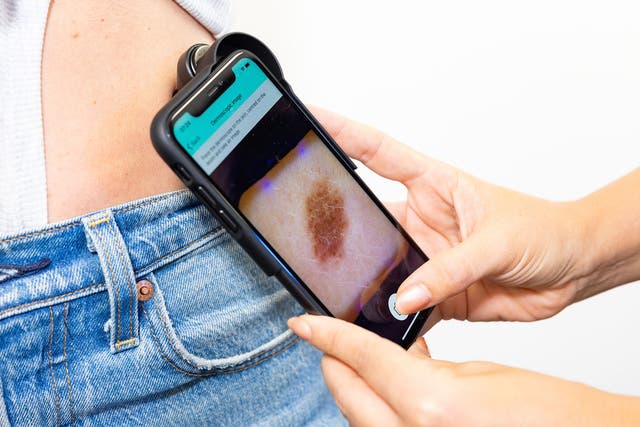 <p>A study of more than 33,000 people who had survived skin cancer <a href="https://www.independent.co.uk/life-style/health-and-families/tattoo-ink-melanoma-skin-cancer-b2839542.html"></a>found there was a 14 per cent risk reduction from taking oral nicotinamide. </p>