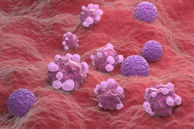<p>Ovarian cancer cells under the microscope</p>