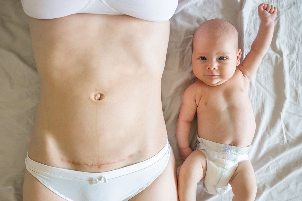 Most mums have horror stories – but trauma-dumping only makes new parents more anxious