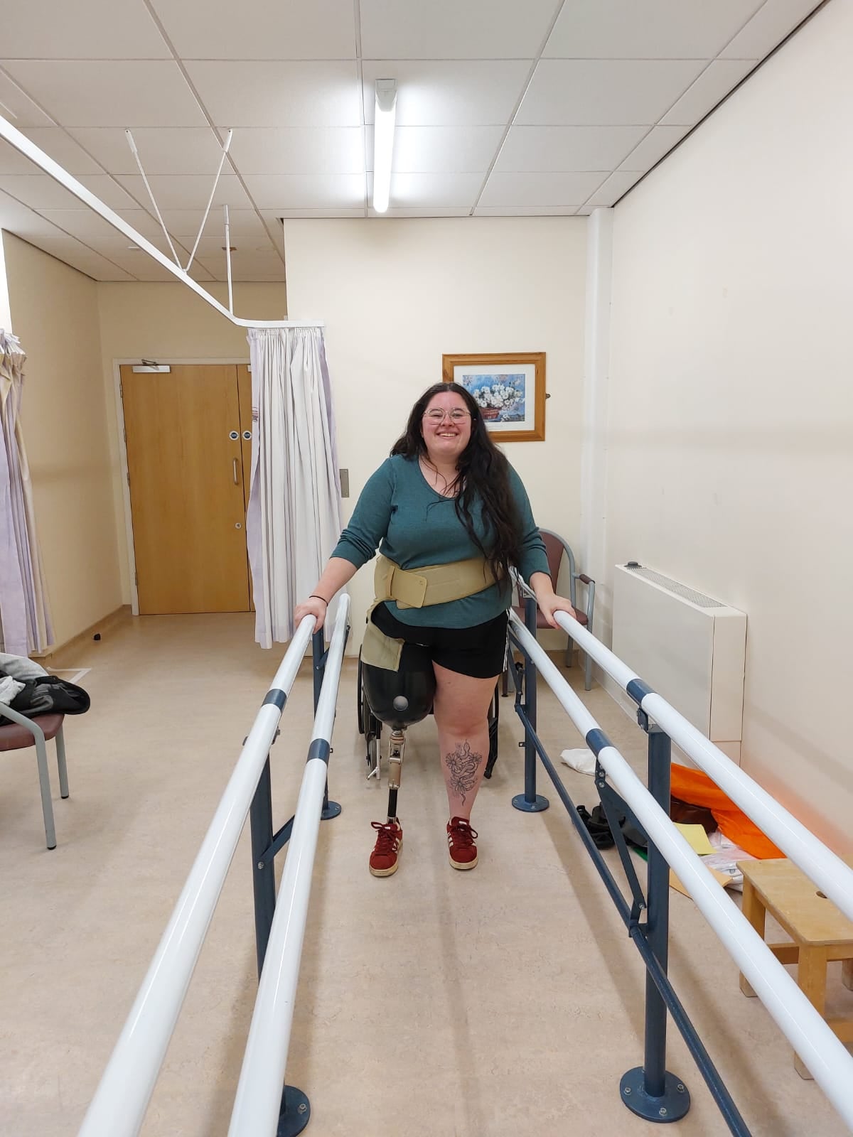 Ms Fay said it took a long time to get used to walking using a prosthetic leg