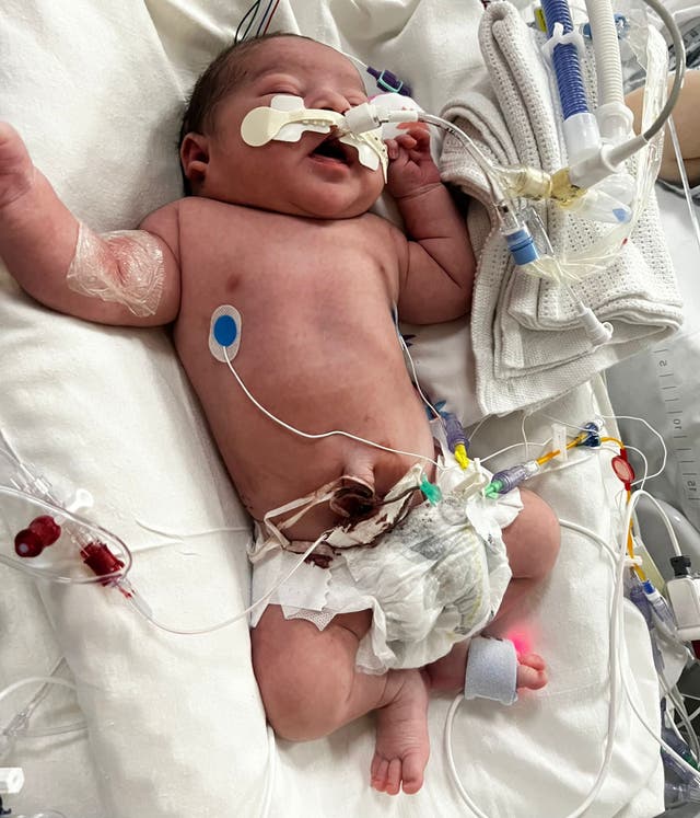 <p>Baby Azlaan was deprived of oxygen and resuscitated for 14 minutes at Bradford Royal Infirmary</p>