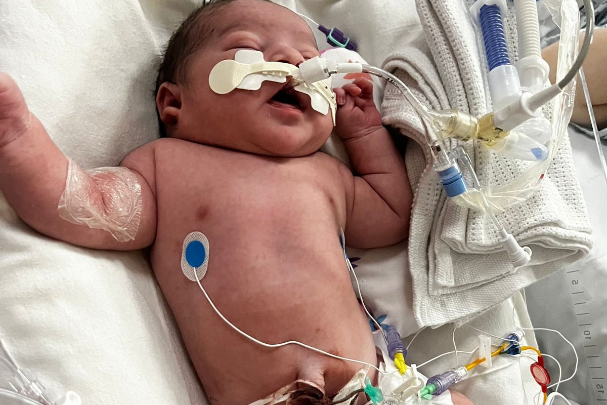 ‘My baby was left with brain damage after he was deprived of oxygen’