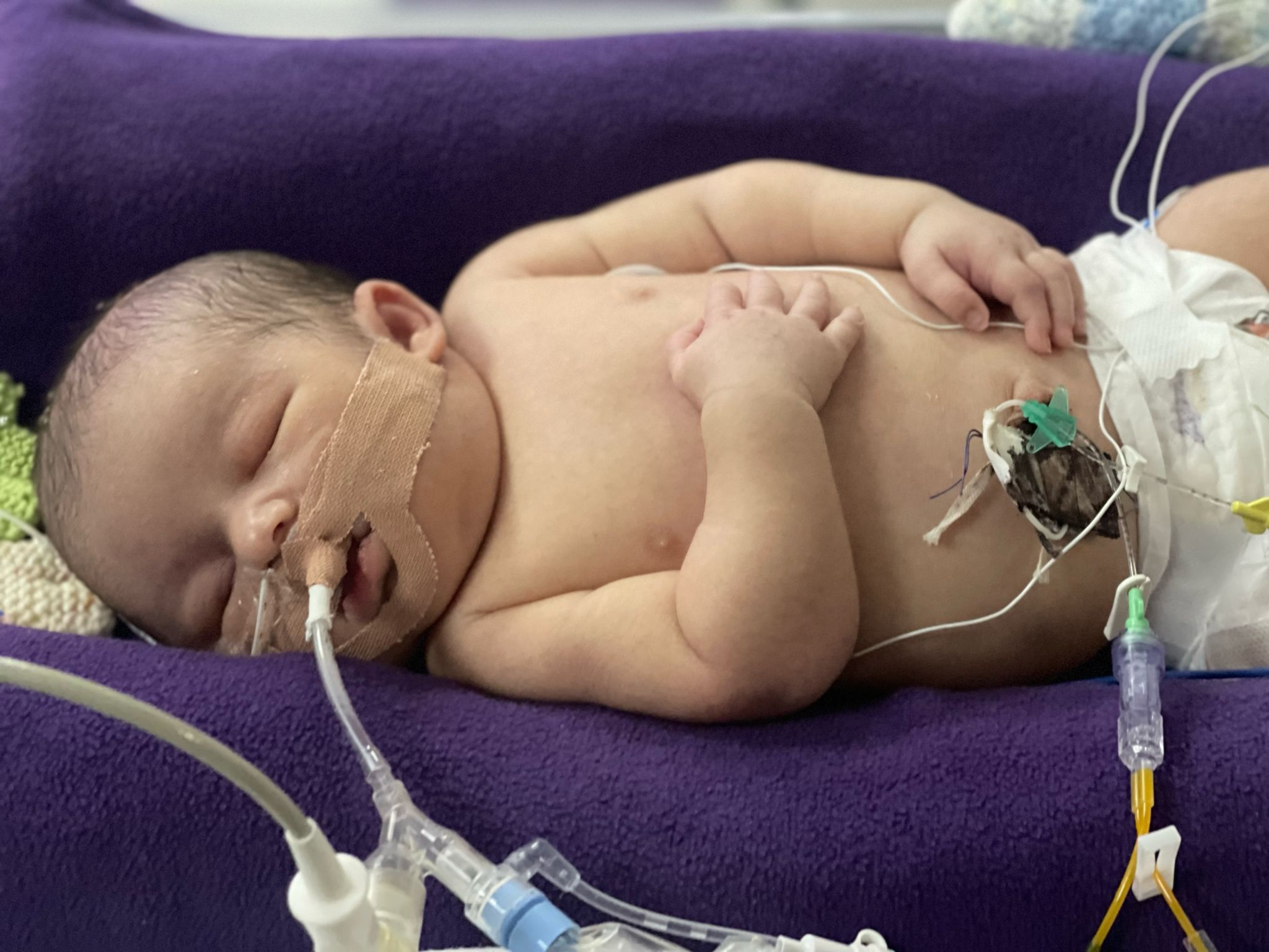 Azlaan was delivered with no heartbeat and had to be resuscitated