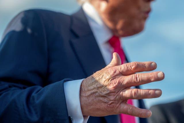 <p>Trump routinely sports bruising on his right hand, often covered in concealer makeup, that his physician attributes to shaking hands and using Tylenol. He is now getting a second physical in less than a year at Walter Reed Medical Center.</p>