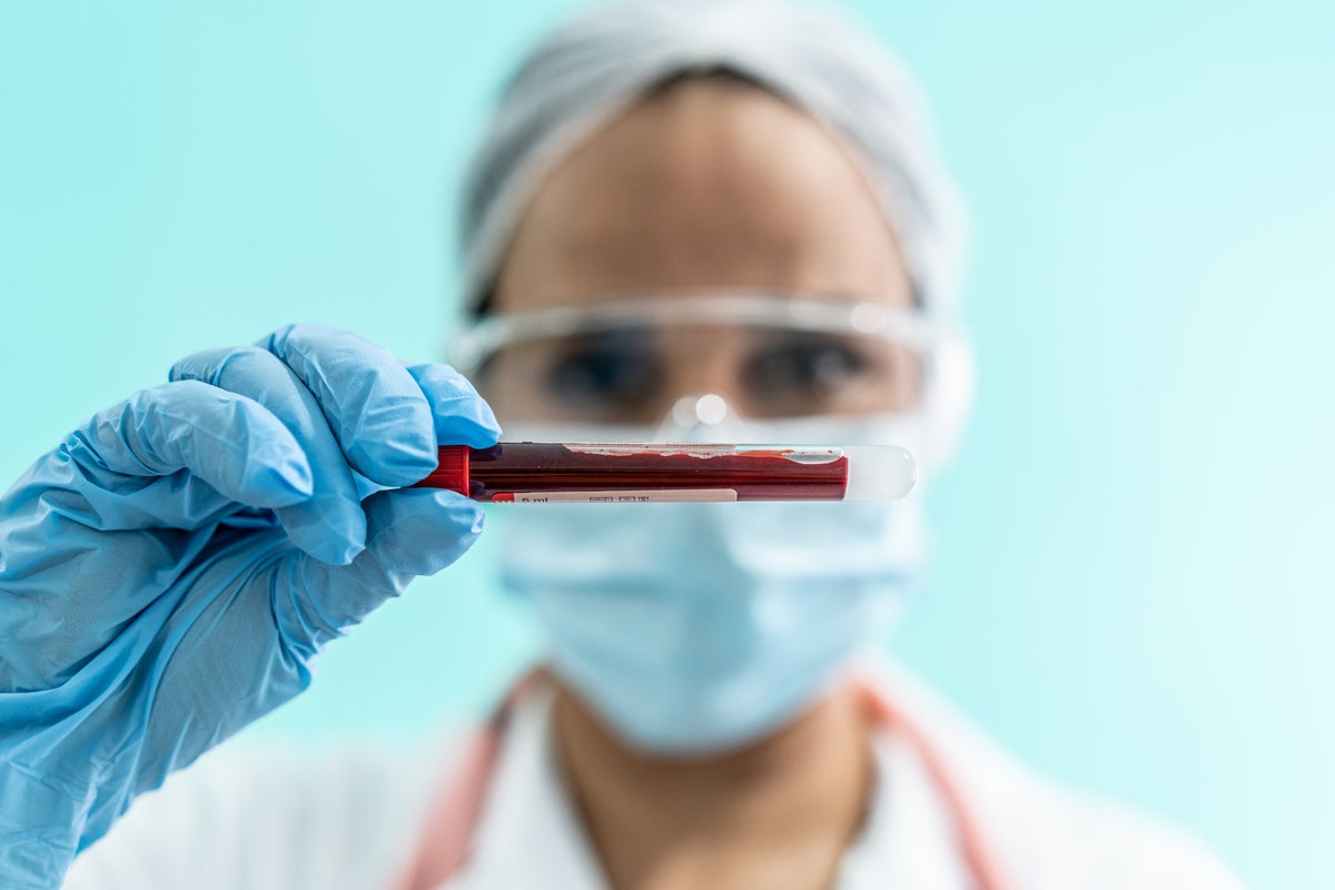 Blood cell breakthrough could ‘significantly advance’ regenerative therapies