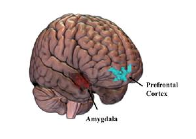 <p>Brain regions altered by PTSD in sexual assault survivors</p>