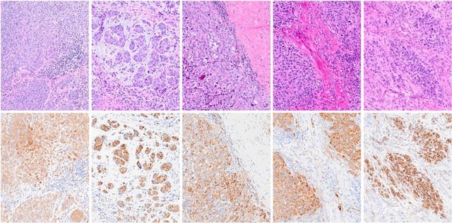 <p>The new research demonstrates the drug can also work preventively</p>