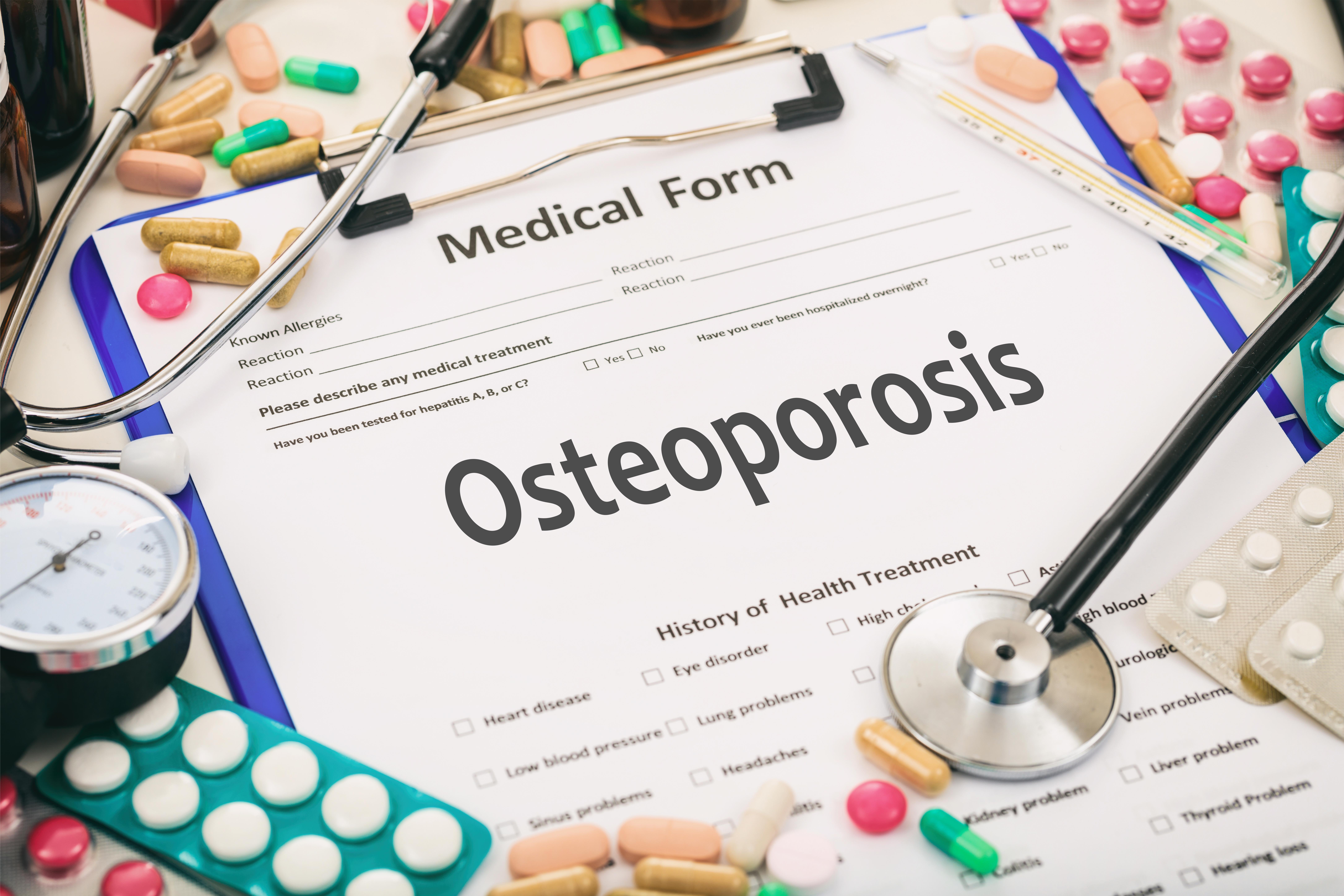 Fewer than a third of patients said they were satisfied with how their osteoporosis is monitored by the NHS.