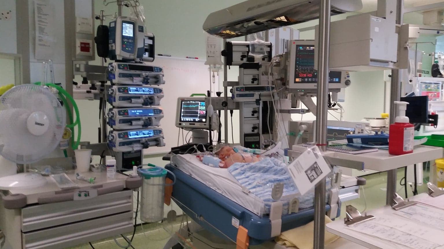 Edison underwent open heart surgery when he was only 10 days old
