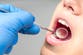 Major new dentistry plan vows to ‘end the postcode lottery’ for treatment