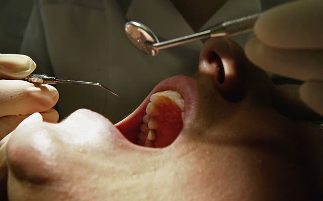 <p>File. Dentist looks in the mouth of a colleague</p>