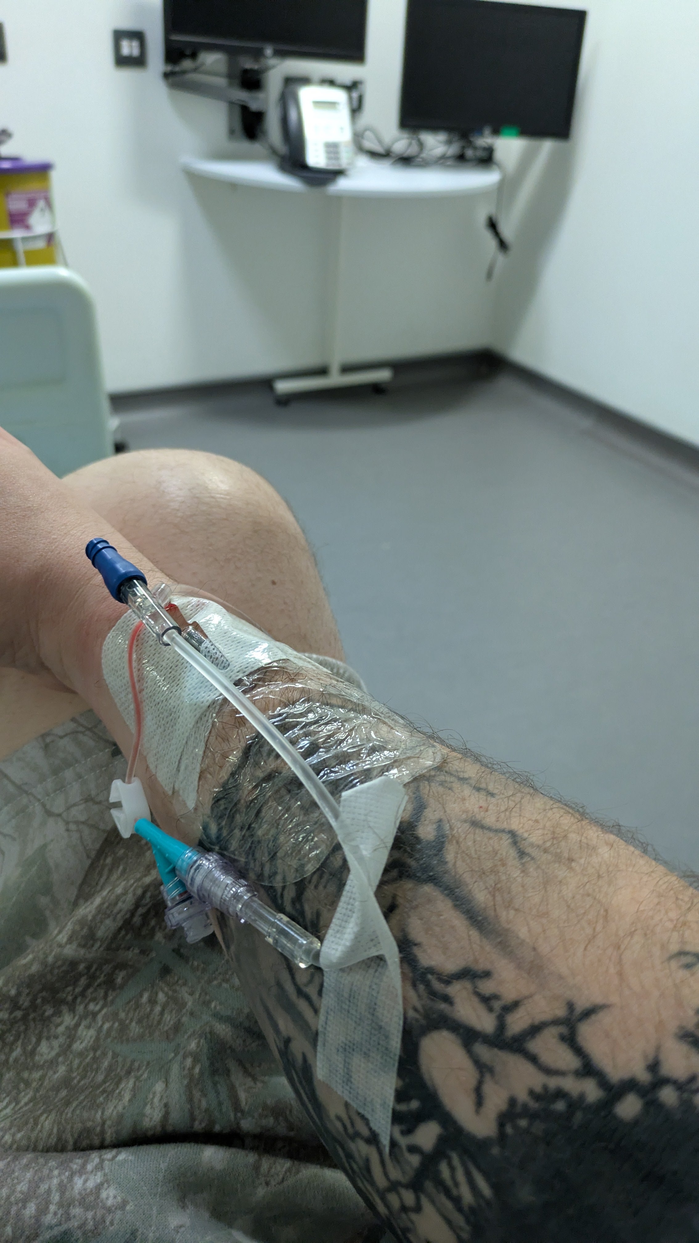 Mat in hospital ready to receive chemotherapy