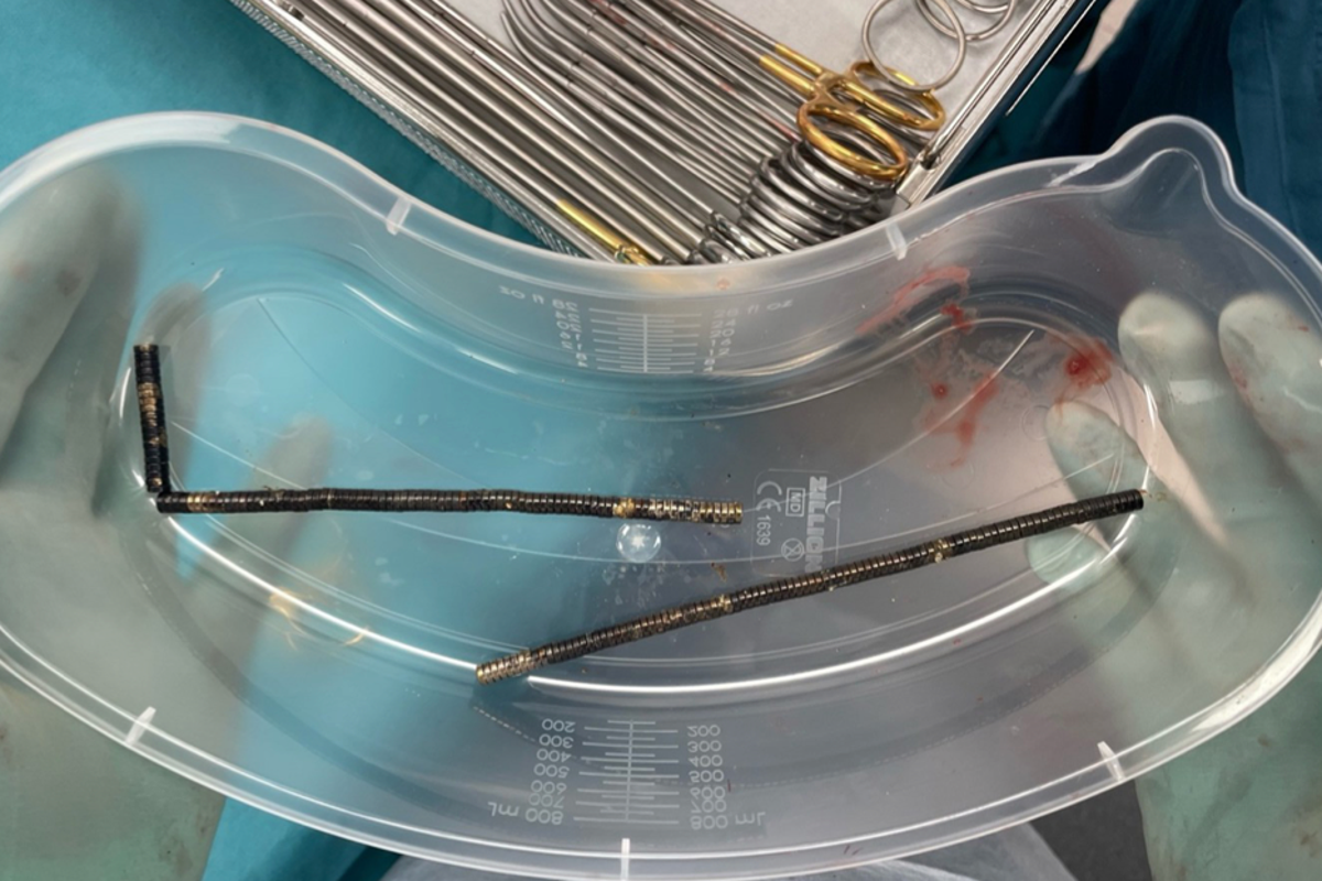https://static.independent.co.uk/2025/10/24/3/28/About-80-to-100-high-powered-magnets-retrieved-from-operation.png?trim=27,0,28,0&width=1200&height=800&crop=1200:800