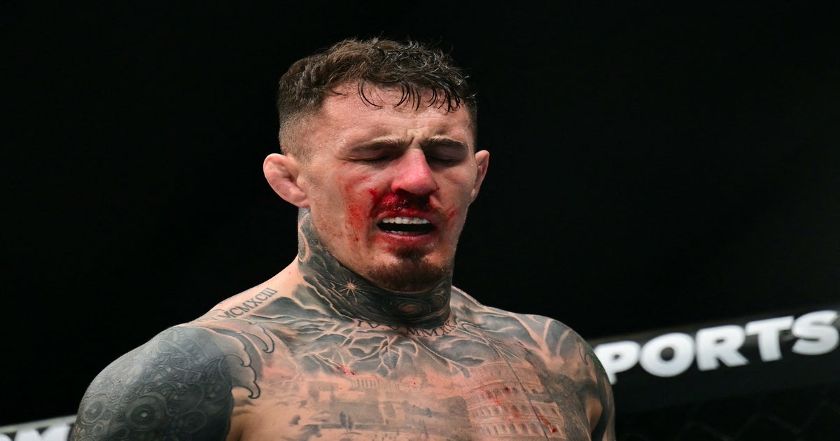 UFC heavyweight champion Tom Aspinall gives health update after eye surgery  | The Independent