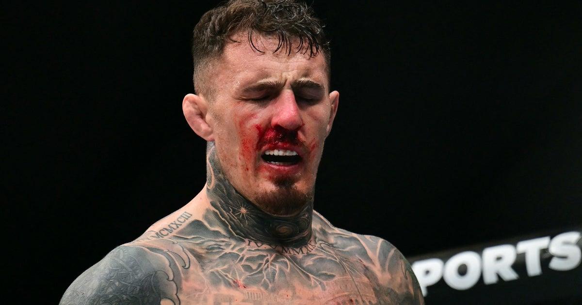 UFC heavyweight champion Tom Aspinall gives health update after eye surgery | The Independent