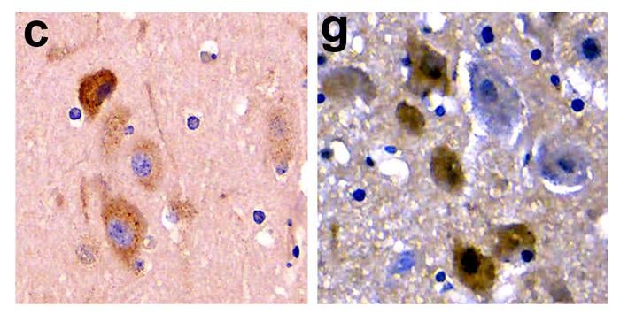 c) Beta-Amyloid-Pathologie im Gehirn eines gestrandeten Delfins g) Tau-Protein im Gehirn eines gestrandeten Delfins