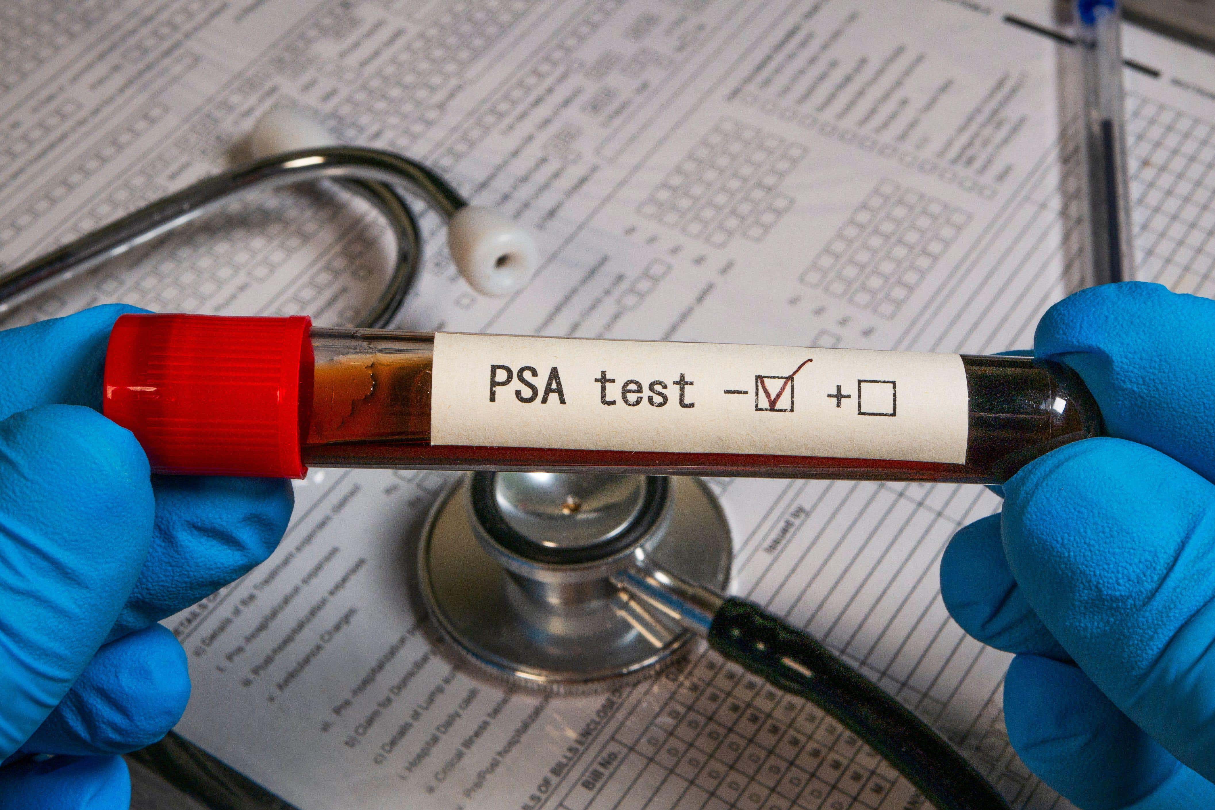 The prostate-specific antigen (PSA) test is a blood test which is currently used to check for prostate conditions (Alamy/PA)