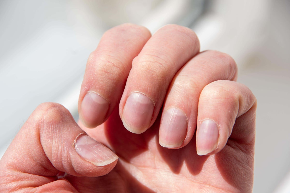 What the look of your nails says about your health